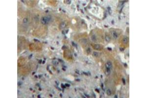 Used in DAB staining on fromalin fixed paraffin-embedded Liver tissue (PLGF Antikörper  (AA 43-162))