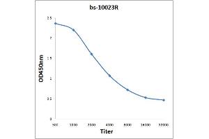 Antigen: 0. (STAT4 Antikörper)