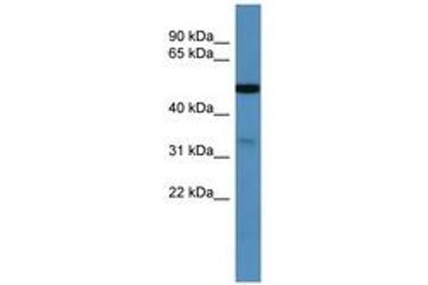 ZDHHC3 Antikörper  (C-Term)