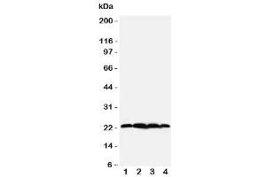 Western blot testing of BAG2 antibody (BAG2 Antikörper  (N-Term))