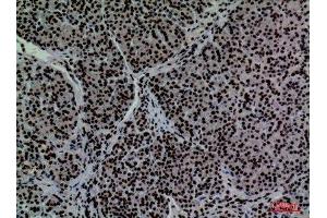 Immunohistochemistry (IHC) analysis of paraffin-embedded Human Pancreas, antibody was diluted at 1:100. (CD2 Antikörper  (N-Term))