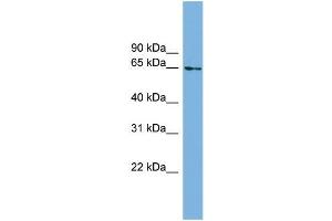Human Heart; WB Suggested Anti-C8orf45 Antibody Titration: 0. (C8orf45 Antikörper  (Middle Region))
