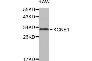 Western blot analysis of extracts of RAW264. (KCNE1 Antikörper)