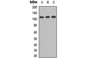 Western blot analysis of CD41 LC 1 expression in A549 (A), MCF7 (B), PC12 (C) whole cell lysates. (CD41 LC 1 (C-Term) Antikörper)