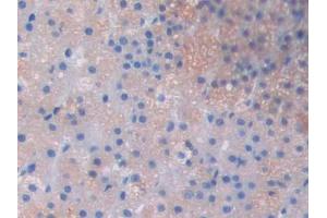 Used in DAB staining on fromalin fixed paraffin- embedded skeletal muscle tissue (LOXL2 Antikörper  (AA 434-546))