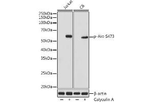 Western blot analysis of extracts of various cell lines, using Phospho-Akt-S473 antibody (ABIN7265522) at 1:1000 dilution. (AKT 1/2/3 Antikörper  (pSer472))