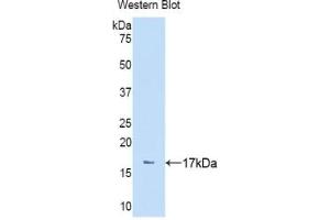 Western blot analysis of the recombinant protein. (NPEPPS Antikörper  (AA 141-272))