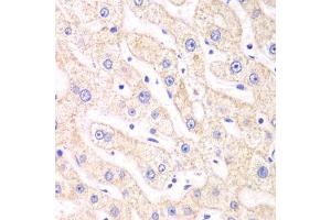 Immunohistochemistry of paraffin-embedded human liver injury using PSMF1 antibody (ABIN5973235) at dilution of 1/100 (40x lens). (PSMF1 Antikörper)