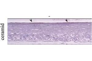 Sections of 3D organotypic skin equivalents were stained for ceramide. (Ceramide Antikörper)