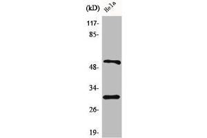 Western Blot analysis of HeLa cells using Caspase-10 B/C Polyclonal Antibody (Caspase 1 Antikörper  (C-Term))