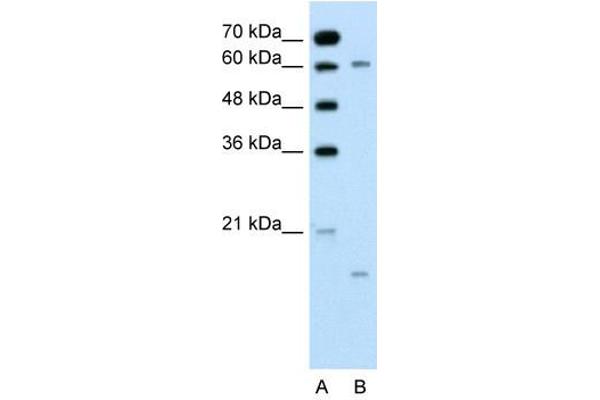 CYP4A22 Antikörper  (N-Term)