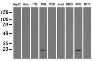 Image no. 2 for anti-Crystallin, alpha B (CRYAB) antibody (ABIN1497644) (CRYAB Antikörper)