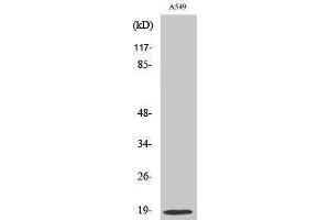 Western Blotting (WB) image for anti-Stathmin 1 (STMN1) (Ser732) antibody (ABIN3176674) (Stathmin 1 Antikörper  (Ser732))