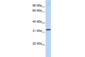 WB Suggested Anti-JMJD8 Antibody Titration: 0. (JMJD8 Antikörper  (Middle Region))