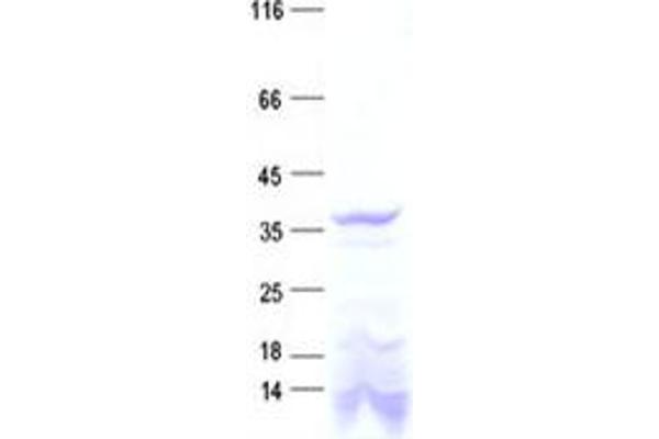 DTWD1 Protein (His tag)