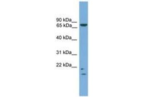 Image no. 1 for anti-MRE11 Meiotic Recombination 11 Homolog A (S. Cerevisiae) (MRE11A) (AA 35-84) antibody (ABIN6745121) (Mre11 Antikörper  (AA 35-84))
