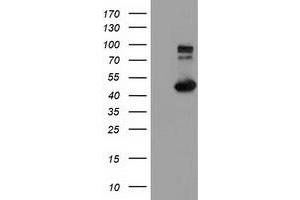 Western Blotting (WB) image for anti-Intraflagellar Transport 57 Homolog (IFT57) antibody (ABIN1498810) (IFT57 Antikörper)