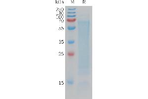 Human CD300LG Protein, His Tag on SDS-PAGE under reducing condition. (CD300LG Protein (AA 19-247) (His tag))