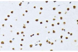 Immunohistochemistry of paraffin-embedded Rat brain using Phospho-ATF2(T69/T71) Polyclonal Antibody at dilution of 1:100 (40x lens). (ATF2 Antikörper  (pThr69, pThr71))