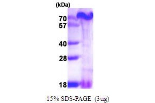 PAGR1 Protein (AA 1-254) (His tag)