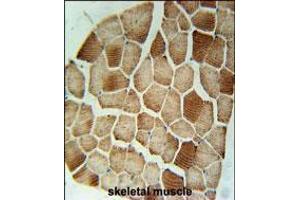 STX7 Antibody immunohistochemistry analysis in formalin fixed and paraffin embedded human skeletal muscle followed by peroxidase conjugation of the secondary antibody and DAB staining. (Syntaxin 7 Antikörper  (N-Term))