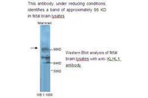 Image no. 1 for anti-Kelch-Like 1 (KLHL1) antibody (ABIN790846) (KLHL1 Antikörper)