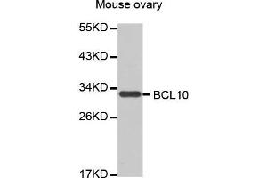 Western Blotting (WB) image for anti-B-Cell CLL/lymphoma 10 (BCL10) antibody (ABIN1678837) (BCL10 Antikörper)