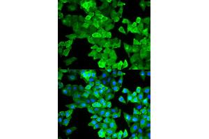 Immunofluorescence (IF) image for anti-Caldesmon 1 (CALD1) antibody (ABIN1876554) (Caldesmon Antikörper)