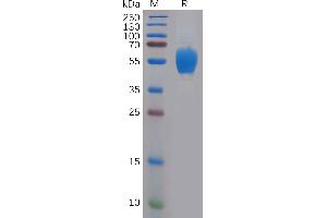 Human F Protein, His Tag on SDS-PAGE under reducing condition. (FGFR4 Protein (AA 22-369) (His tag))