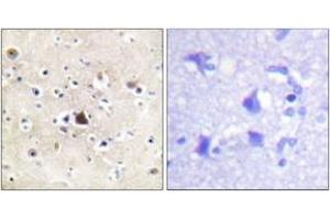 Immunohistochemistry (IHC) image for anti-Nuclear Receptor Subfamily 3, Group C, Member 1 (Glucocorticoid Receptor) (NR3C1) (AA 201-250) antibody (ABIN2888632) (Glucocorticoid Receptor Antikörper  (AA 201-250))