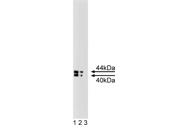 IGFBP3 Antikörper  (AA 101-210)