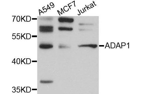 ADAP1 Antikörper  (AA 1-374)