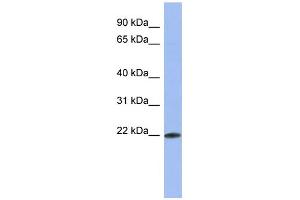 WB Suggested Anti-RBM38 Antibody Titration:  0. (RBM38 Antikörper  (Middle Region))