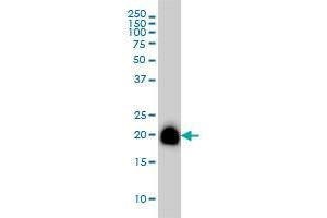 RHOA monoclonal antibody (M08), clone 1C3 Western Blot analysis of RHOA expression in A-431 . (RHOA Antikörper  (AA 1-193))