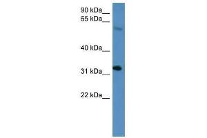 Hoxd13 antibody used at 0. (Homeobox D13 Antikörper  (C-Term))