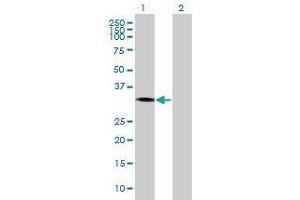 Lane 1: OGFOD2 transfected lysate ( 32. (OGFOD2 293T Cell Transient Overexpression Lysate(Denatured))