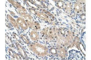 GEM antibody was used for immunohistochemistry at a concentration of 4-8 ug/ml to stain Epithelial cells of renal tubule (arrows) in Human Kidney. (GEM Antikörper  (C-Term))