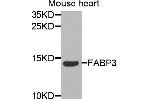 Western blot analysis of extracts of mouse heart, using FABP3 antibody (ABIN5973057) at 1/1000 dilution. (FABP3 Antikörper)