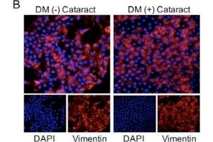 Immunofluorescence (Cultured Cells) (IF (cc)) image for anti-Vimentin (VIM) antibody (ABIN2854814)