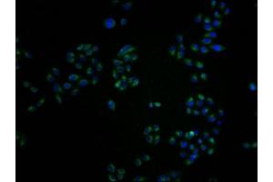 Immunofluorescence staining of Hela cells with ABIN7161163 at 1:100, counter-stained with DAPI. (MME Antikörper  (AA 386-617))