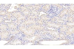 Detection of ALOX15 in Human Kidney Tissue using Monoclonal Antibody to Arachidonate-15-Lipoxygenase (ALOX15) (ALOX15 Antikörper  (AA 170-312))