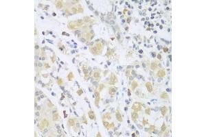 Immunohistochemistry of paraffin-embedded human stomach using SGCB antibody. (SGCB Antikörper)