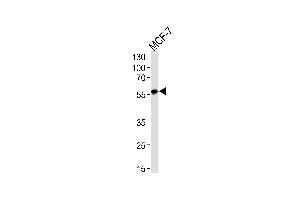 Western blot analysis of lysate from MCF-7 cell line, using ACVRL1 Antibody at 1:1000. (ACVRL1 Antikörper  (N-Term))