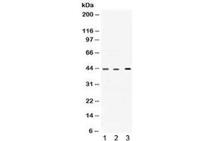 Western blot testing of 1) rat heart, 2) human HepG2 and 3) human A549 lysate with VEGFD antibody. (VEGFD (VEGF4) (AA 89-205) Antikörper)