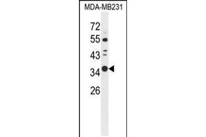 Western blot analysis of STX7 Antibody in MDA-MB231 cell line lysates (35ug/lane) (Syntaxin 7 Antikörper  (N-Term))