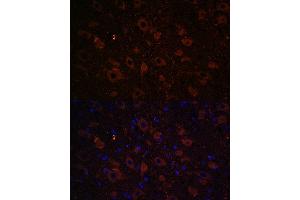 Immunofluorescence analysis of rat brain using Dopamine Transporter/SLC6 Rabbit pAb (ABIN7270474) at dilution of 1:100 (40x lens). (SLC6A3 Antikörper  (C-Term))