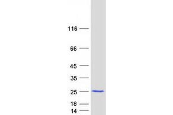 MSRB3 Protein (Transcript Variant 2) (Myc-DYKDDDDK Tag)