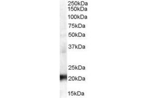 Western Blotting (WB) image for anti-Coiled-Coil Domain Containing 176 (CCDC176) (N-Term) antibody (ABIN2156539) (C14orf45 Antikörper  (N-Term))