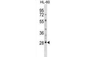 Western Blotting (WB) image for anti-Lymphocyte Antigen 6 Complex, Locus G6F (LY6G6F) antibody (ABIN2999007) (LY6G6F Antikörper)