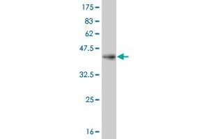 Western Blot detection against Immunogen (36. (IRAK4 Antikörper  (AA 255-351))